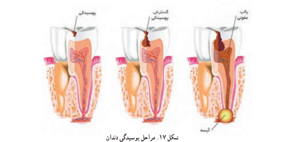 سلامت و بهداشت دوازدهم صفحه ۹۷ چاپ ۱۴۰۳