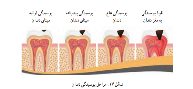سلامت و بهداشت دوازدهم صفحه ۹۷ چاپ ۱۴۰۴